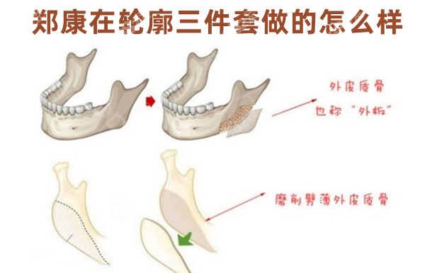 郑康在轮廓三件套做的怎么样