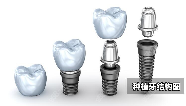 三明瑞尔口腔价格介绍