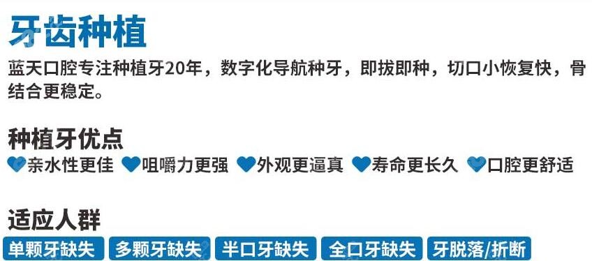 广西蓝天口腔种植牙技术特色 广西蓝天口腔种植牙技术特色