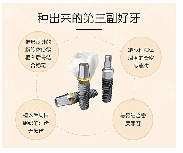 美国品牌种植体排行