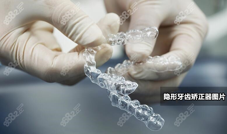 三明瑞尔口腔牙齿矫正价格