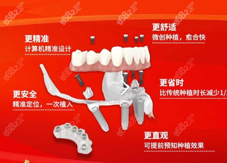 玉林种植牙多钱一颗2022价格 玉林种植牙多钱一颗2022价格