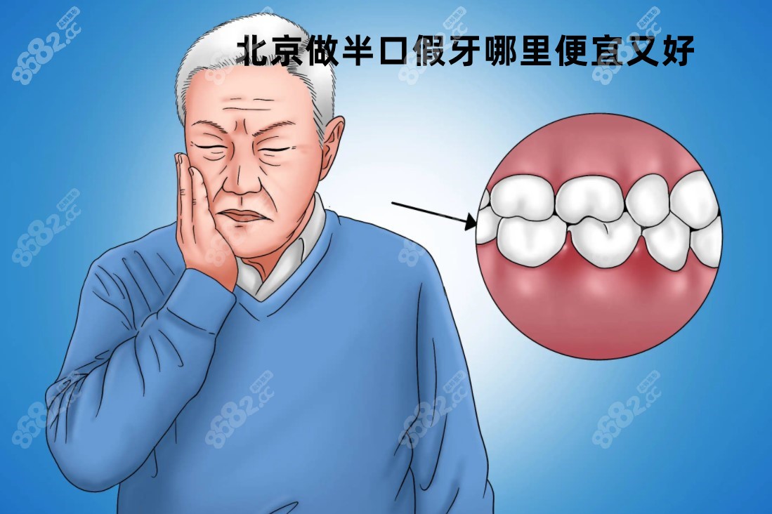 北京做半口假牙哪里便宜又好呢