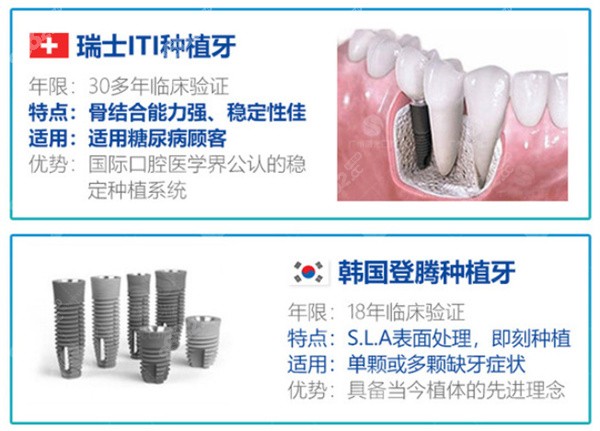 瑞士ITI、韩国登腾种植牙特点、优势介绍 瑞士ITI、韩国登腾种植牙特点、优势介绍