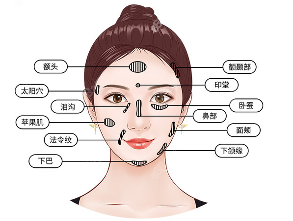 南宁华美做脂肪填充的价位