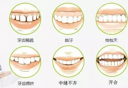 适合牙齿矫正症状