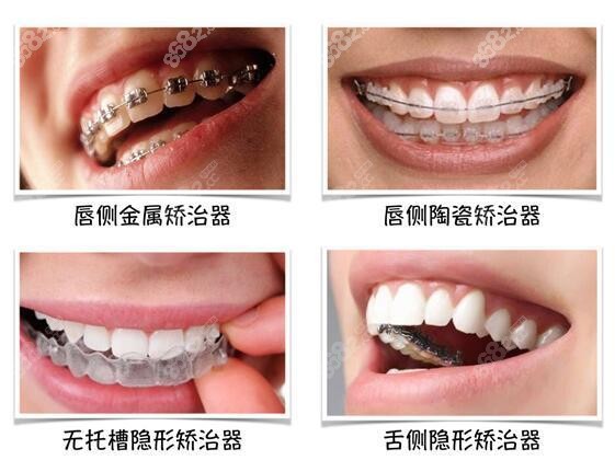 福州贝臣齿科矫正牙齿的价格