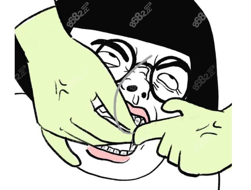 适合做牙齿瓷贴面的症状