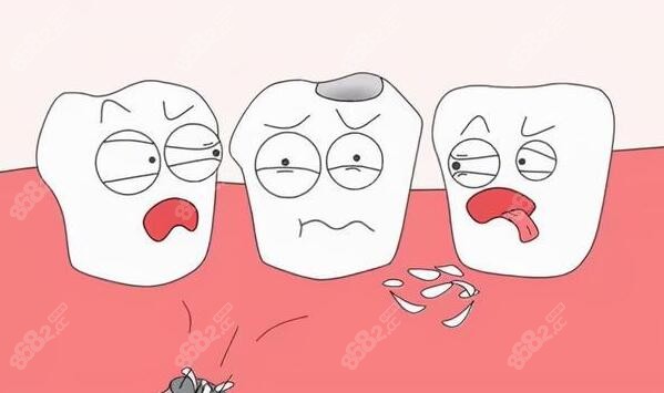 医生不建议做牙齿贴面的原因