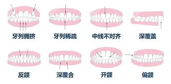 益阳牙齿矫正好的口腔医院排名