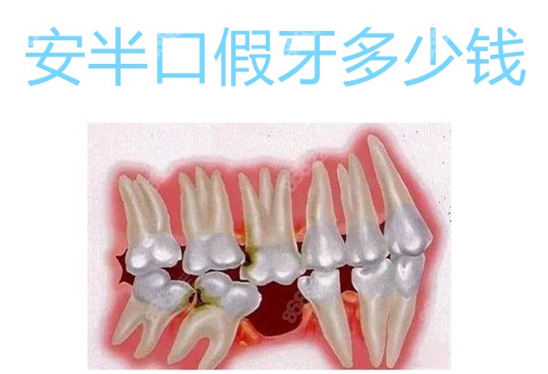 安半口假牙多少钱