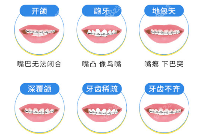 重庆鹏博口腔做牙齿矫正怎么样