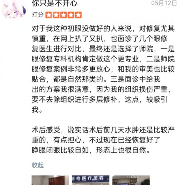 师丽丽院长双眼皮修复评价