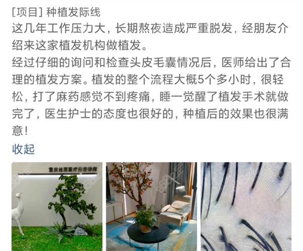 重庆丝粟植发口碑1