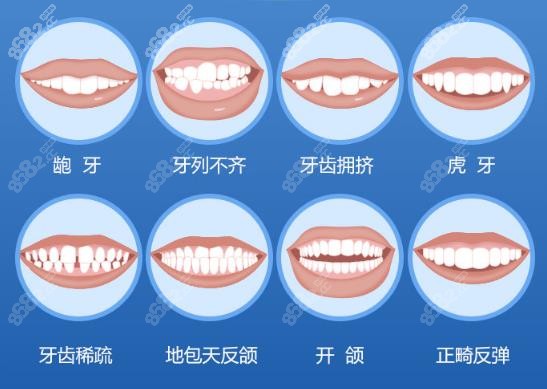 福州贝臣口腔牙齿矫正类型