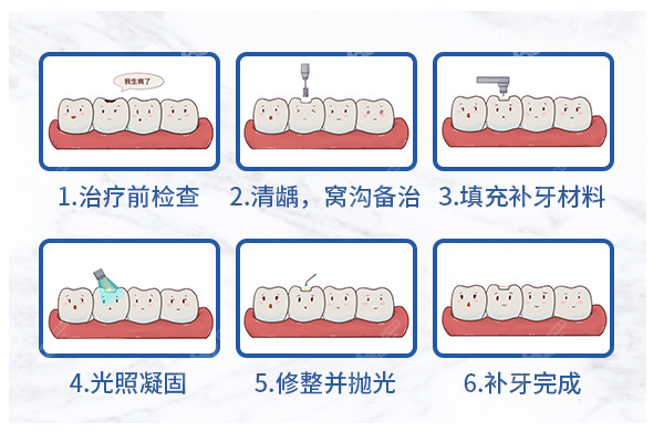 杭州德贝口腔补牙多少钱一颗