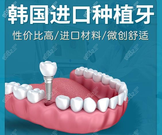 福州鼓楼区韩国进口种植牙价格