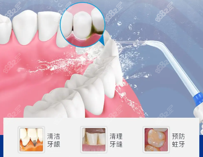 杭州德贝口腔洗牙价格贵吗