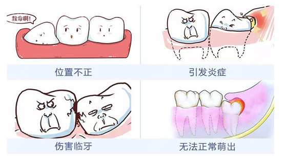 柳州哪个医院拔智齿便宜