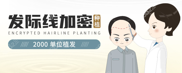 男生植发发际线图片