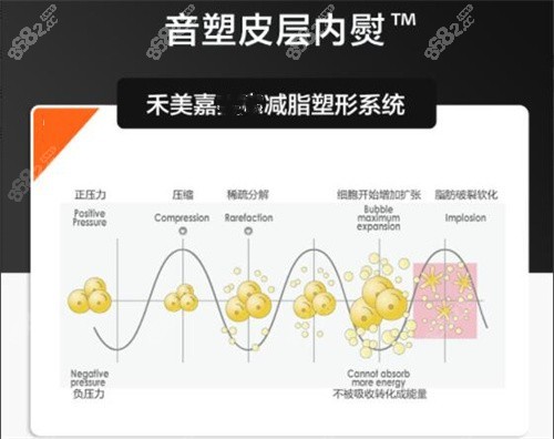 任学会音速皮层内熨技术