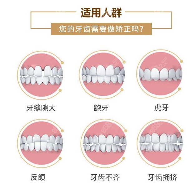 呼和浩特矫正牙齿大概多少钱