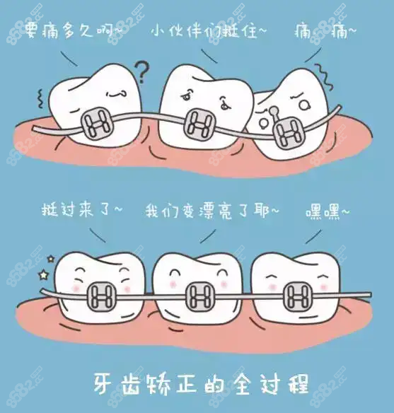 太原牙齿矫正价格表