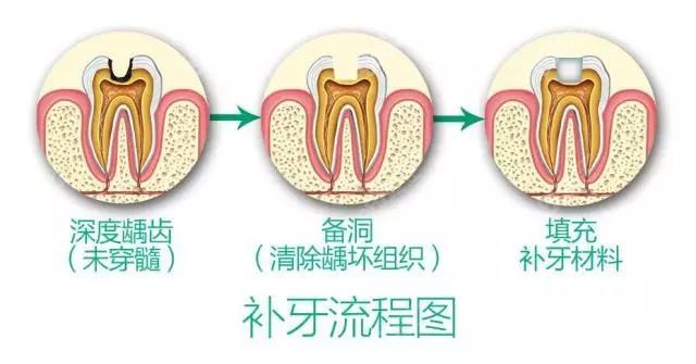 福州登特齿科补牙医生兰宇仁