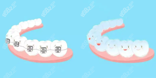 中诺矫正牙齿费用价格表