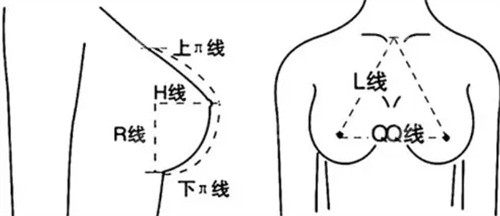 罗盛康隆胸价格多少？