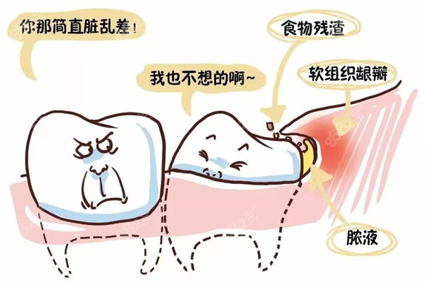 福州登特口腔哪个医生好