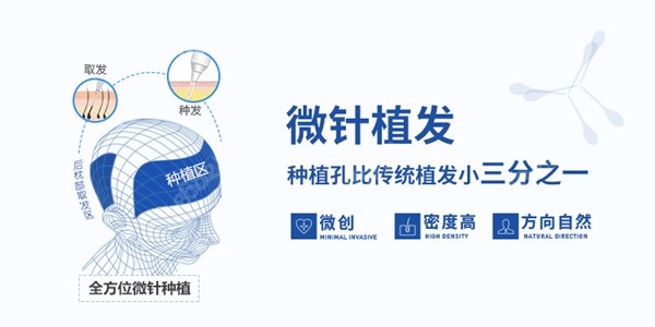 杭州植發(fā)技術(shù)好醫(yī)院排名榜前十名