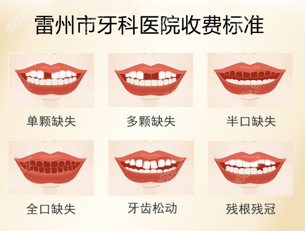雷州市牙科医院收费标准是多少