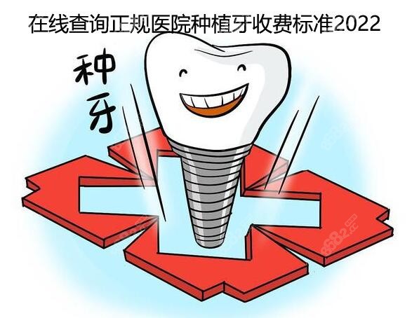 在线查询正规医院种植牙收费标准2022