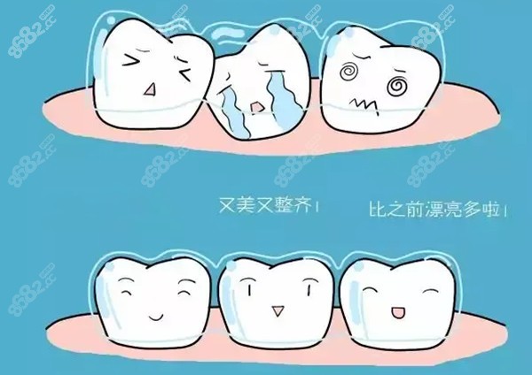 信阳华瑞口腔牙齿矫正价格