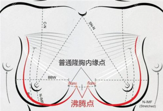 福州海峡林沸腾隆胸厉害