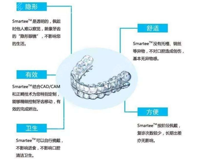 隐适美牙套特点