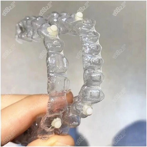 趙郡凡是隱適美認證醫(yī)師 趙郡凡是隱適美認證醫(yī)師