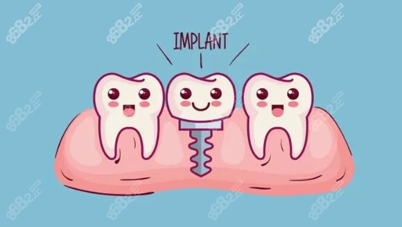 这是种植牙卡通图片