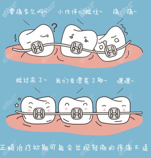 牙齒正畸需要定期復診哦 牙齒正畸需要定期復診哦