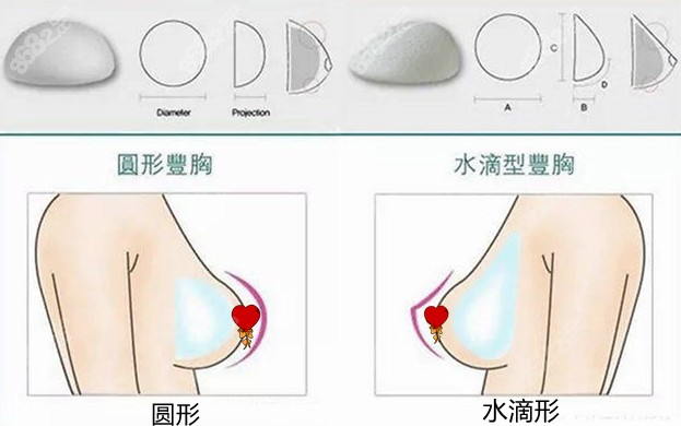 2022罗盛康假体隆胸收费标准