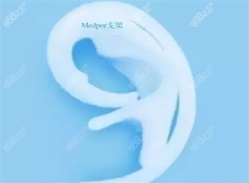耳再造手術(shù)示意圖
