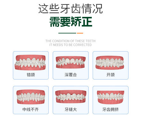 蘭州德爾口腔常做的牙齒矯正類型圖