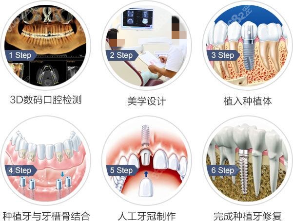 宁德种植牙口腔医院排名