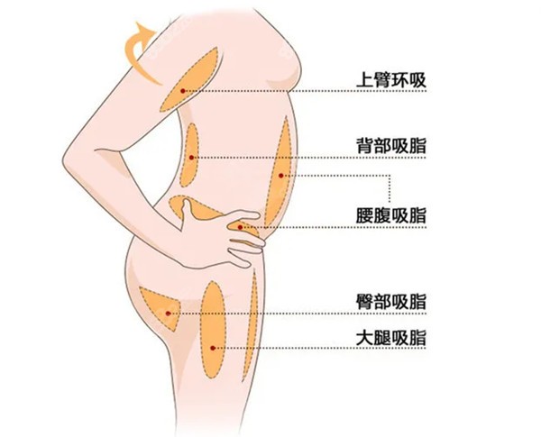 后背吸脂12个部位图图片