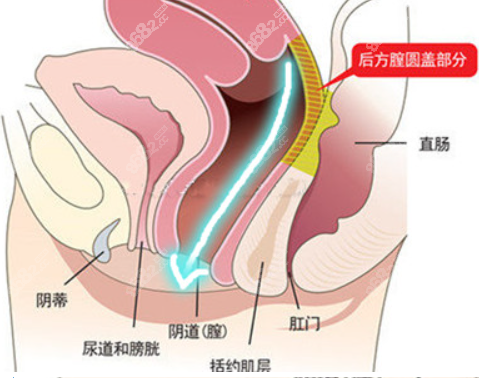 韩国好手艺缩阴手术