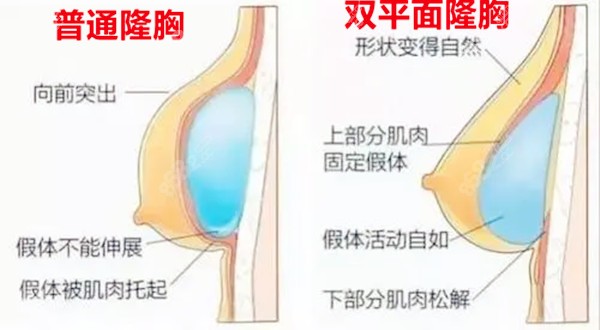 www.8682.cc岳阳隆胸多少钱