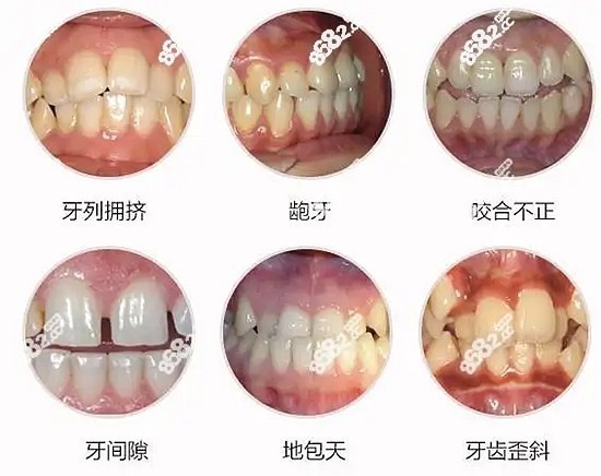 长沙牙齿矫正医院排名前十