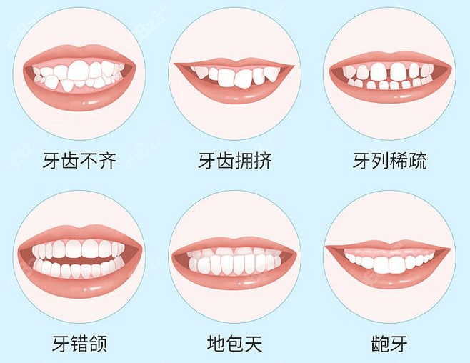 台江口腔医院牙齿矫正费用