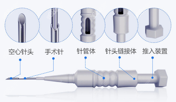 大麦微针发际线不剃发植发价格